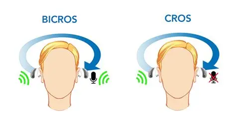 Come funzionano Sistema CROS e BICROS Soluzione per chi ha perdita uditiva monolaterale
